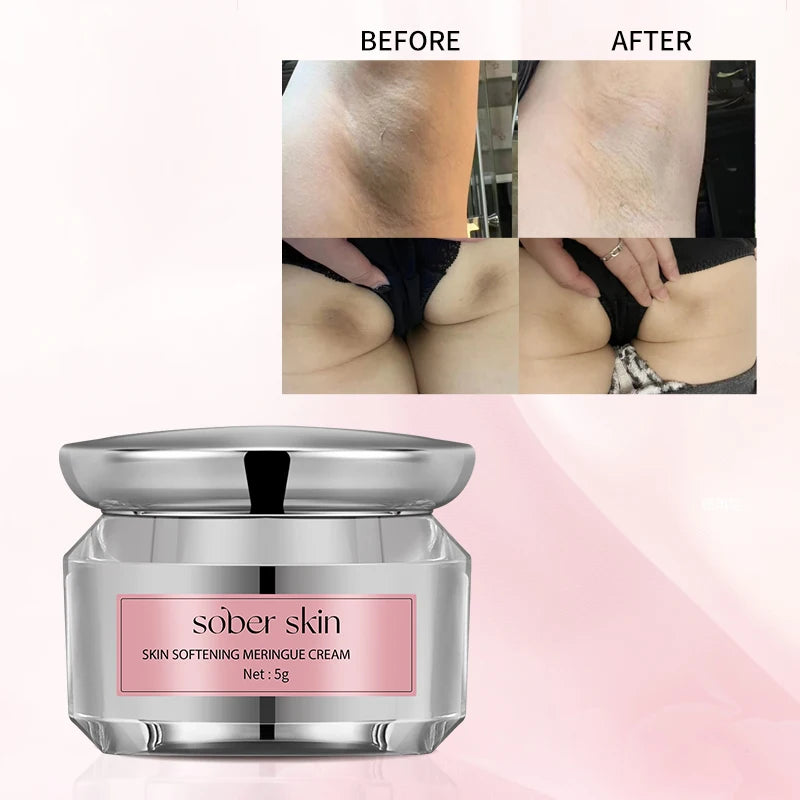 Cream Whitening Armpit, Arm and Knee Private Area Remove Black Moisturizing Body Lotion