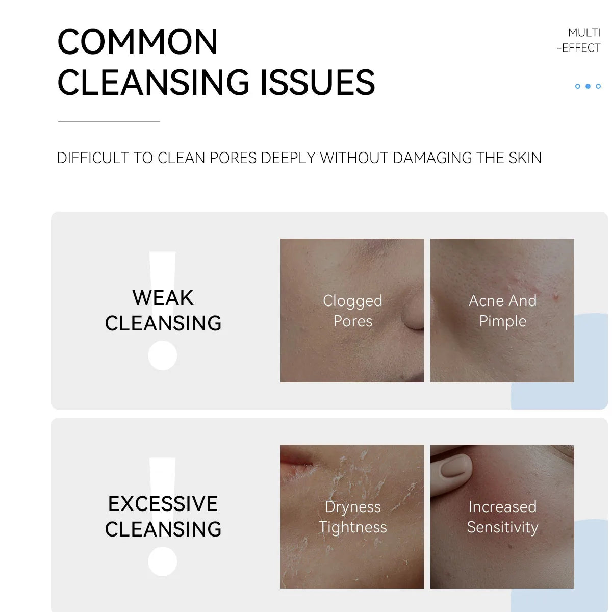 Deep Cleansing Facial Foam Gel - Oil Control Acne Mark Removal