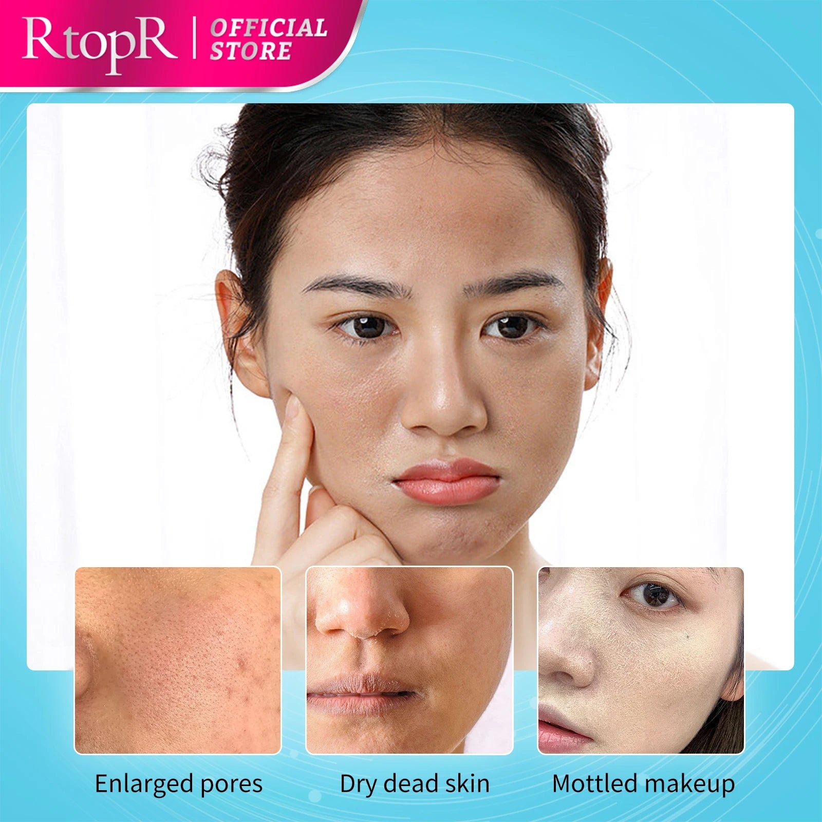 Face Exfoliating Cream for Whitening and Acne Treatment Vervelle