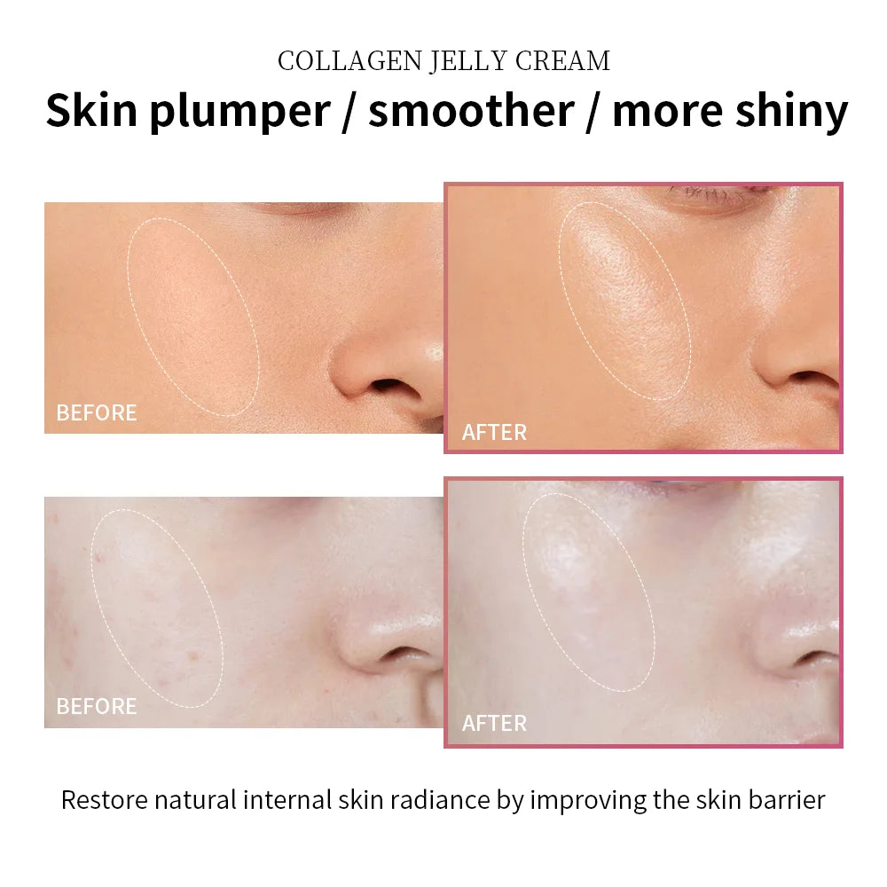 Moisturizing Collagen Jelly Cream Niacinamide Hydrolyzed Collagen