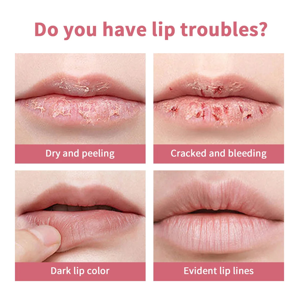 Pink Honey Tinted Lip Balm – Dark Lip Lightening & Exfoliating
