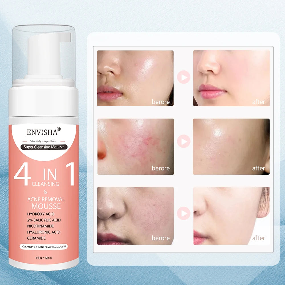 ENVISHA Facial Skin Care Exfoliating Mousse Peeling Gel Deep Remove Cleaning