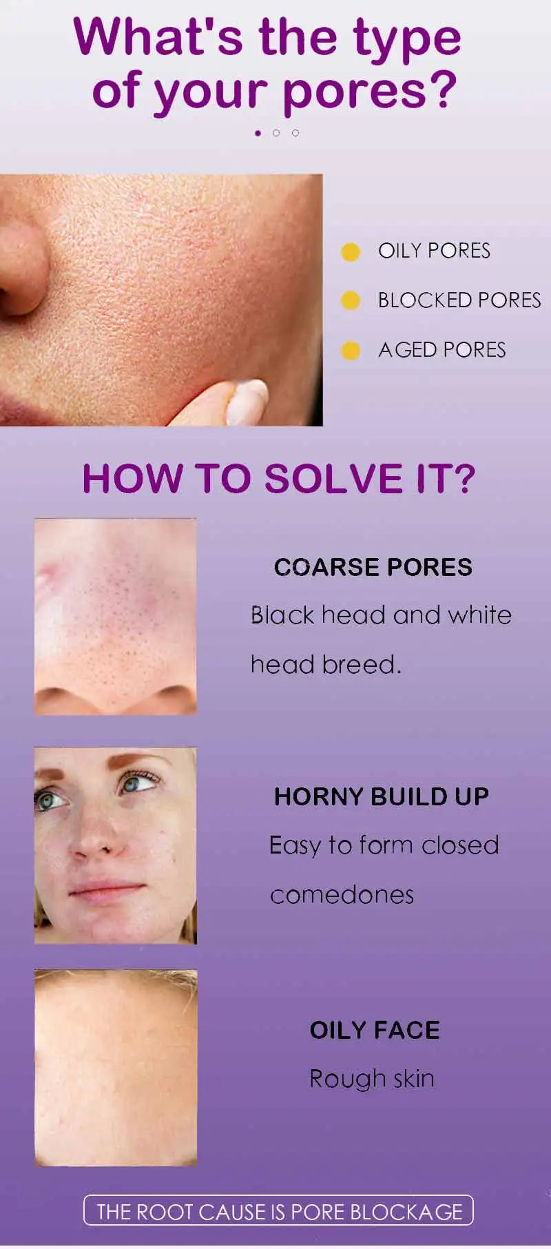 Pore Shrinking Serum Tightening Essence Firm Skin Vervelle