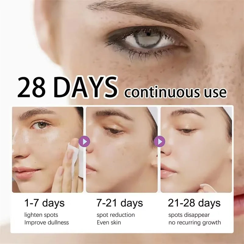 Dark Spot Remover Serum – Korean Anti-Pigmentation Whitening