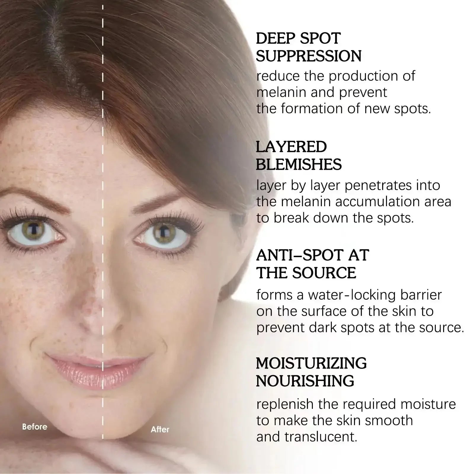 Dark Spot Remover Serum – Korean Anti-Pigmentation Whitening