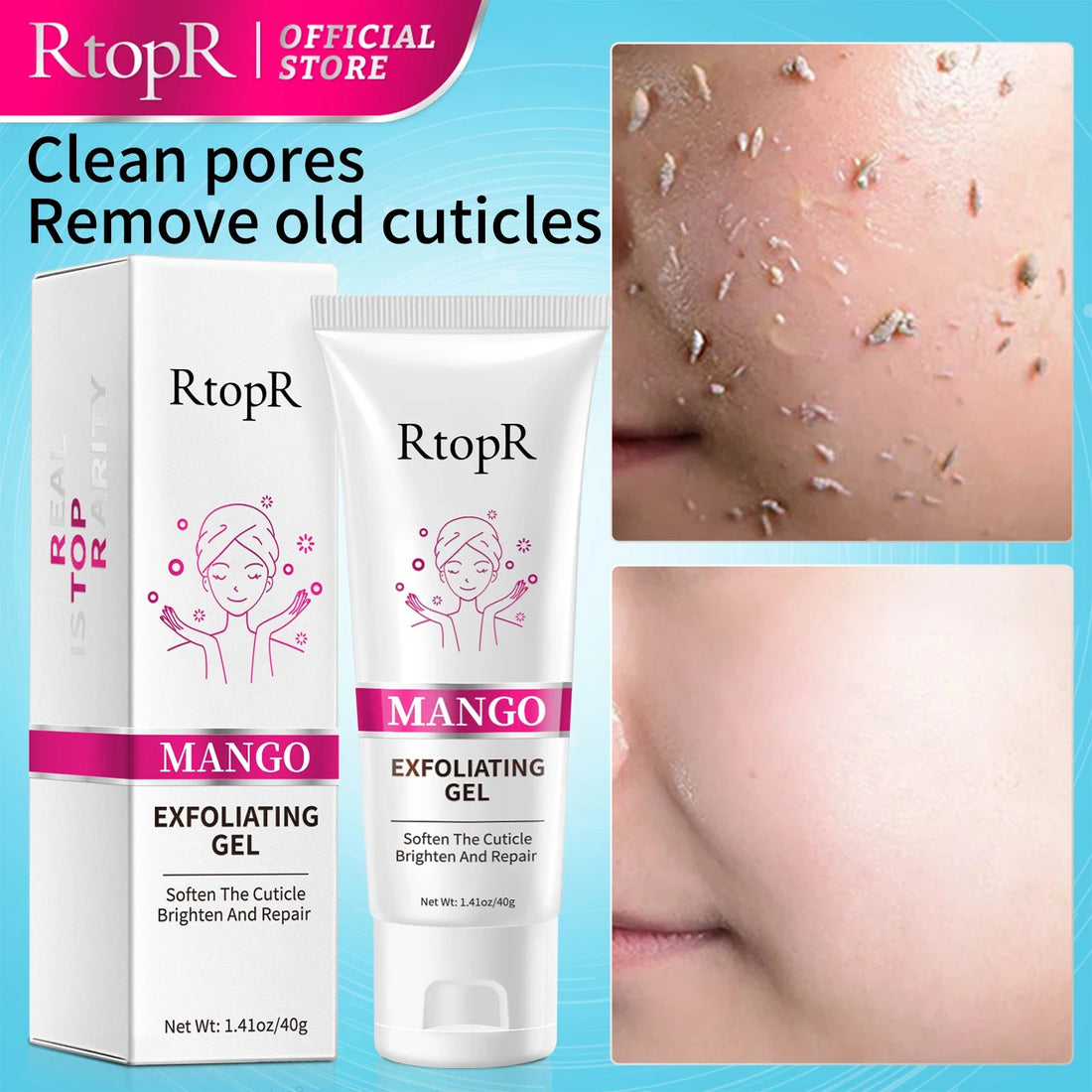 Face Exfoliating Cream for Whitening and Acne Treatment Vervelle