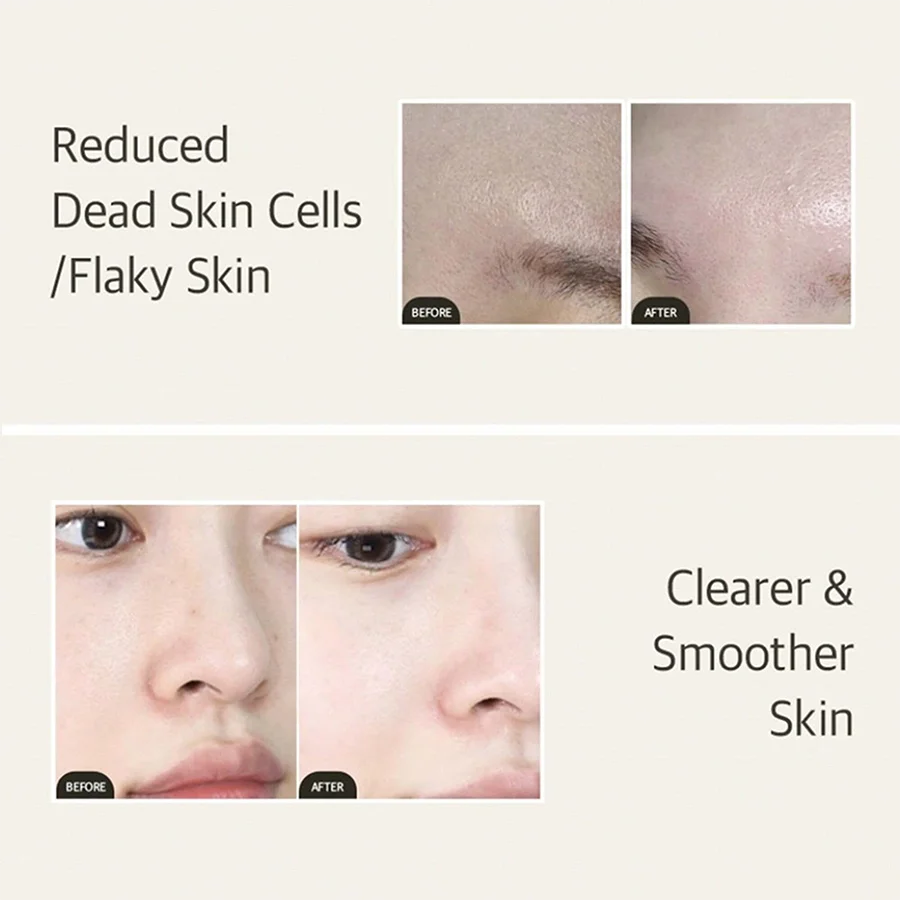 Mixsoon Bean Essence Korean Skin Care Serum - Exfoliating Hydrating Glass Skin