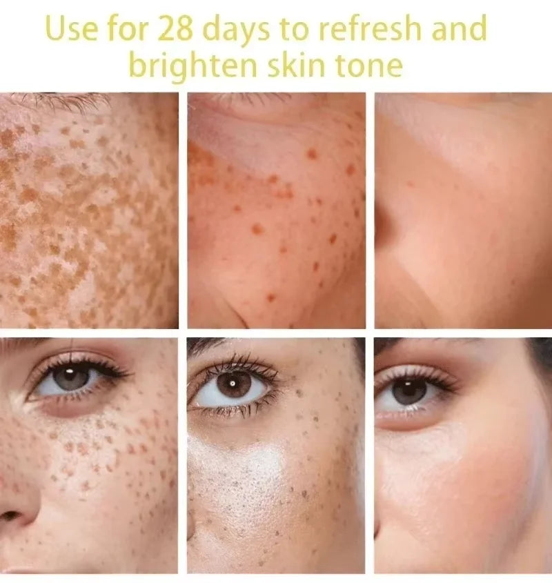 Dark Spot Remover Serum – Korean Anti-Pigmentation Whitening